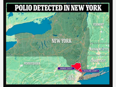 NEW YORK'S TOP DOCTOR: Hundreds May Be Infected With Polio Virus